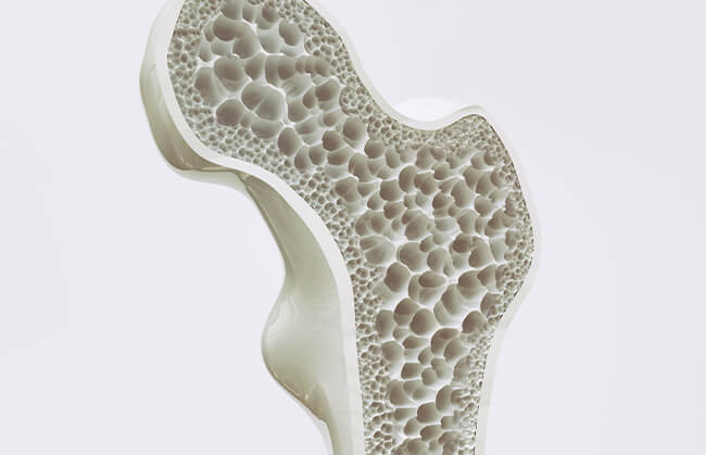 骨が脆くなっているかも?