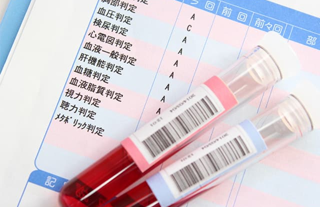 血液検査